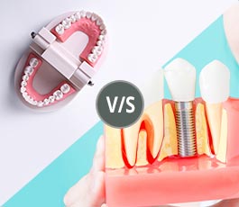 Dentures vs. Implants: Which Is Best For You?